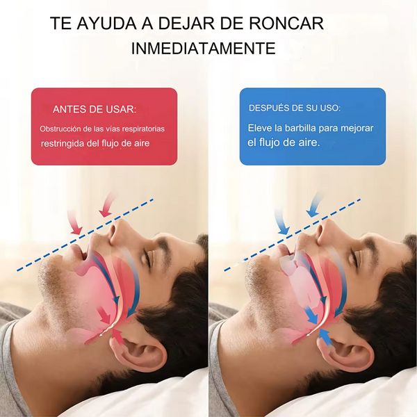 2 EN 1 ANTI RONQUIDO Y PURIFICADOR AIRE