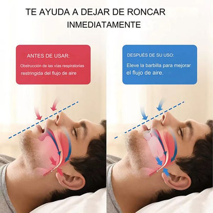 2 EN 1 ANTI RONQUIDO Y PURIFICADOR AIRE
